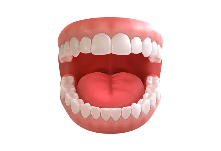Composite Bonding